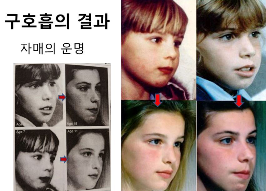 구호흡 자료
