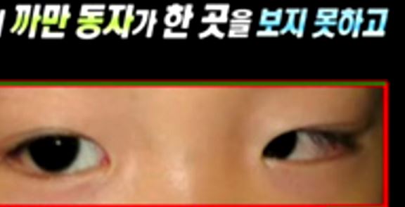 사시 1