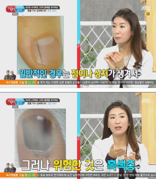 검은색세로줄2
