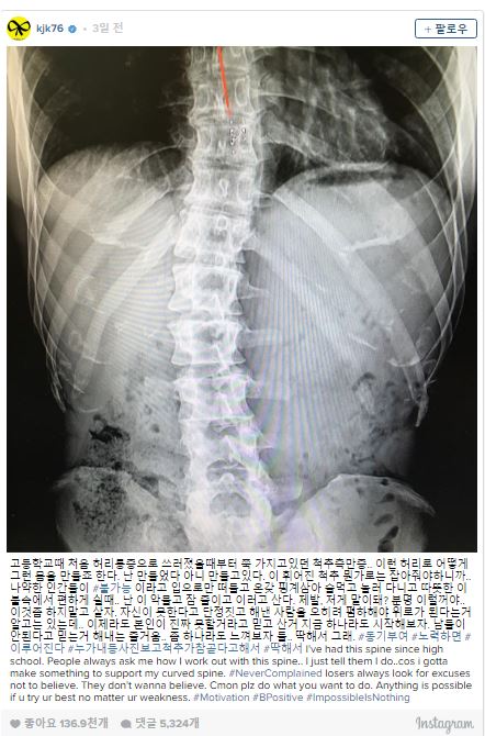 김종국 척추 1