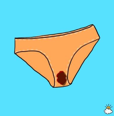 질4