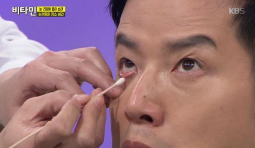 속눈썹 청소 4