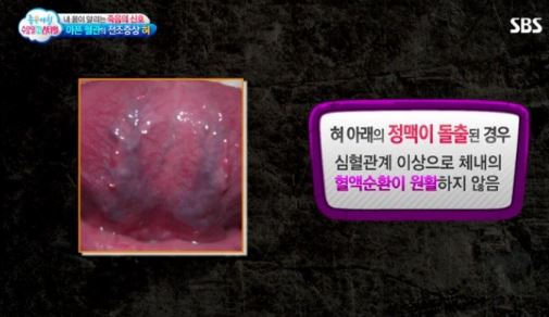 혀 1