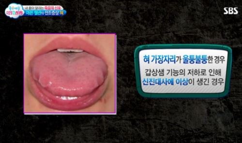 혀 4