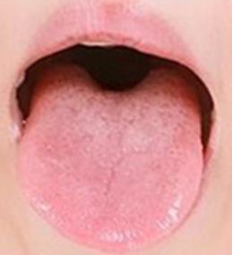 혀색깔3
