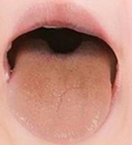 혀색깔6