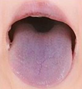 혀색깔7