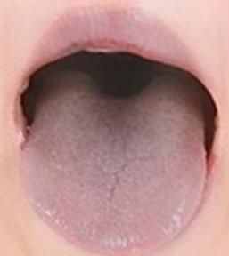 혀색깔8