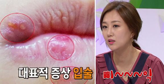 입술 삐익 1