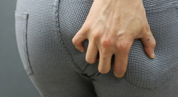 항문