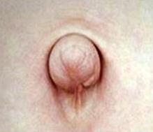 배꼽3