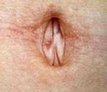 배꼽6