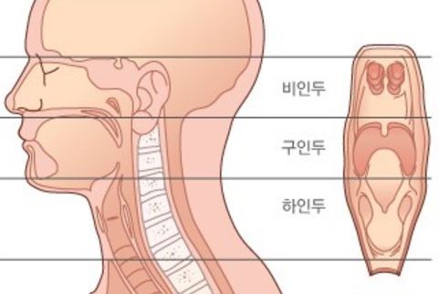 김우빈 비인두암 1