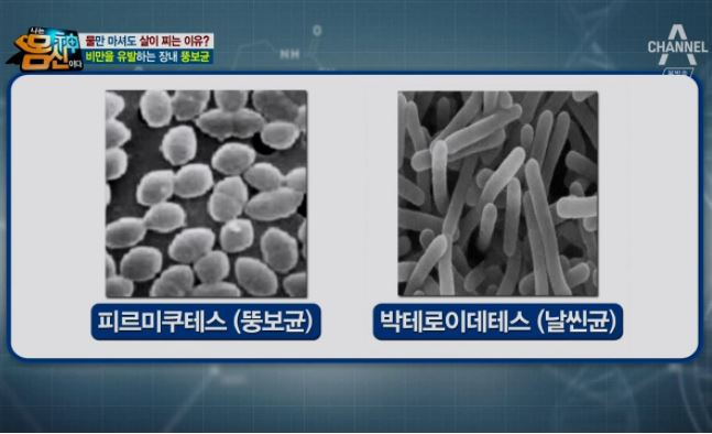 비만 뱃살 주사 3