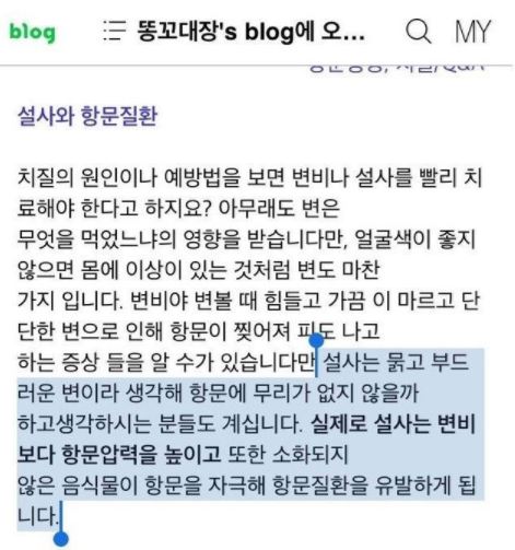 화장시 4