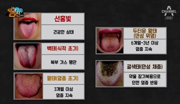 혀 2