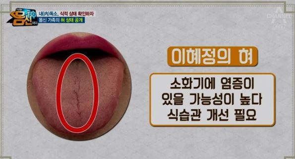 혀 3