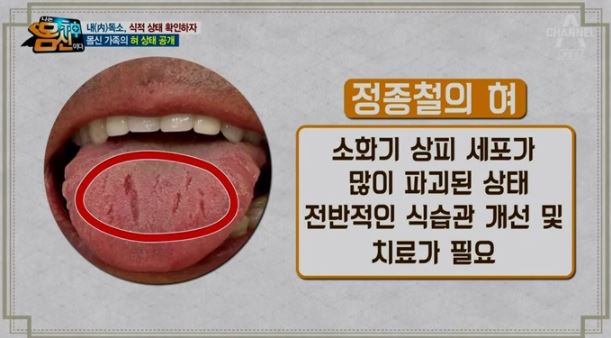 혀 4