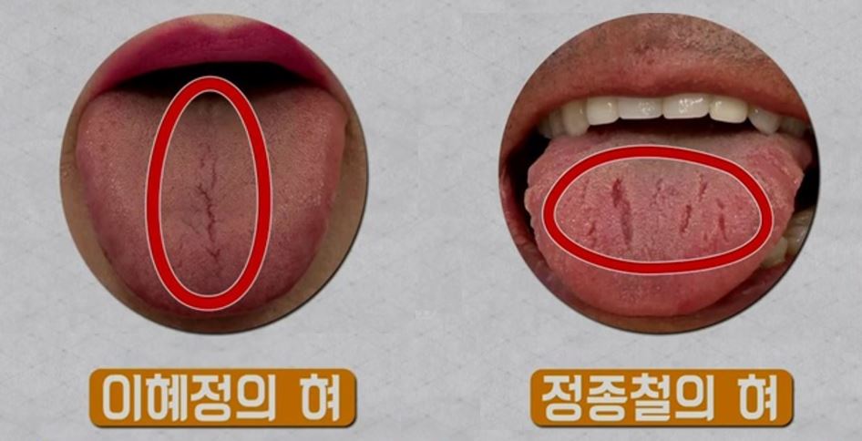 혀 1