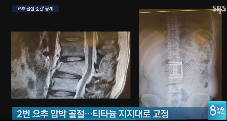 김병만4