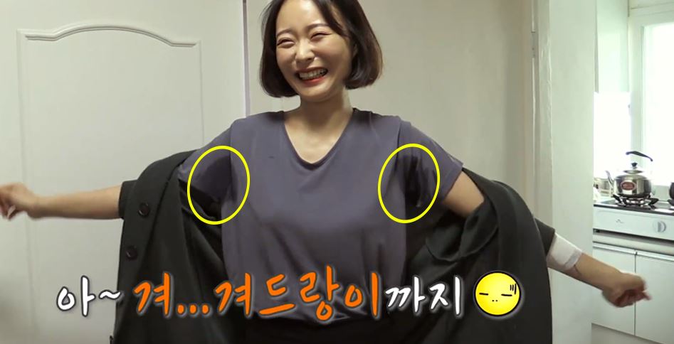 다한증 0