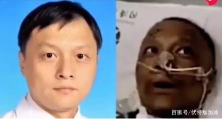 중국 얼굴 검게 변한 코로나 의사 1