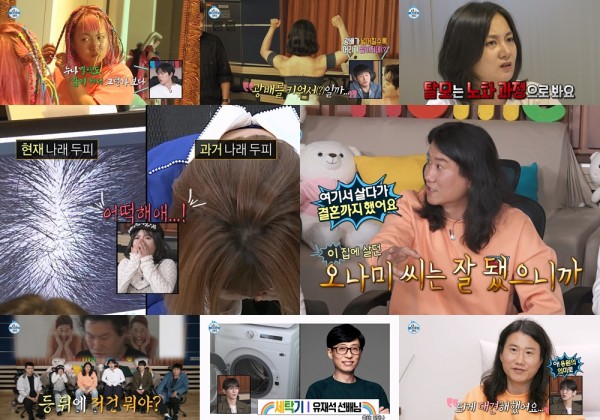 박나래 탈모 고백, 광배와 맞바꾼 머리카락 충격 이미지
